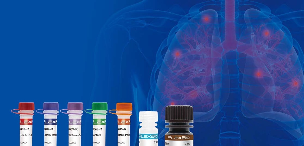 IntelliPlex Lung Cancer Panel – cfRNA (24 reactions)